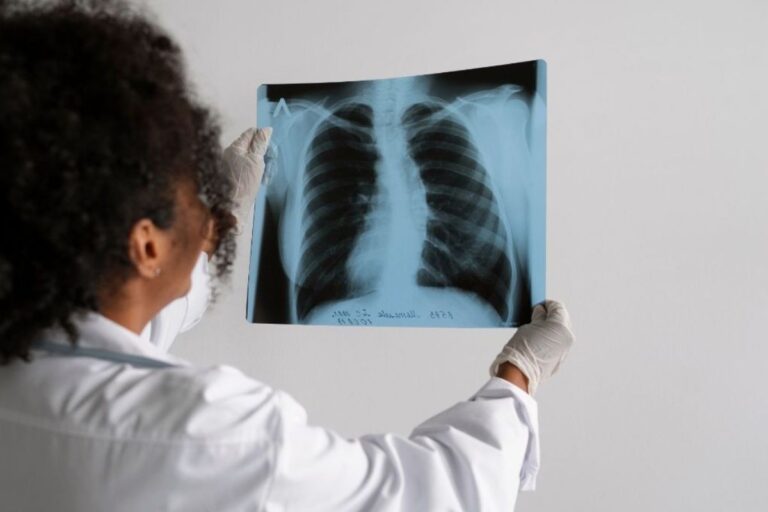 Brasil não atinge meta da OMS para tuberculose; casos aumentam alarmantemente Brasil não atinge meta da OMS para tuberculose; casos aumentam alarmantemente