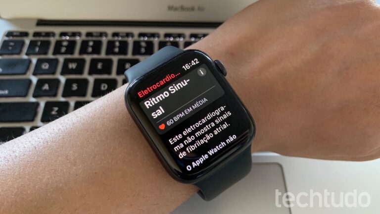 Smartwatches com ECG: 6 Melhores Modelos para Monitorar a Saúde do Coração Smartwatches com ECG: 6 Melhores Modelos para Monitorar a Saúde do Coração